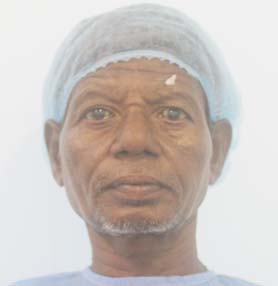 patient Image